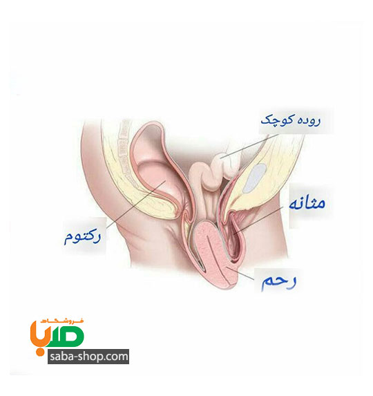 درمان افتادگی رحم