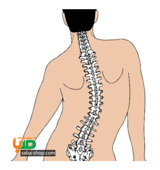 درمان انحراف ستون فقرات (اسکولیوز)