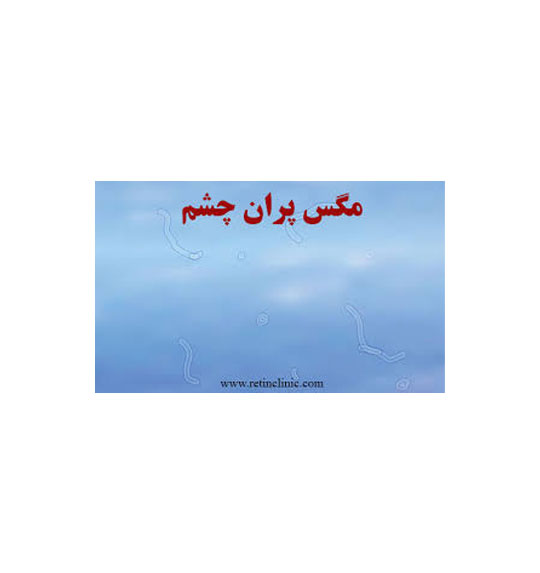 درمان مگس پران